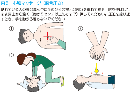 心筋梗塞